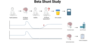 beta Shunt